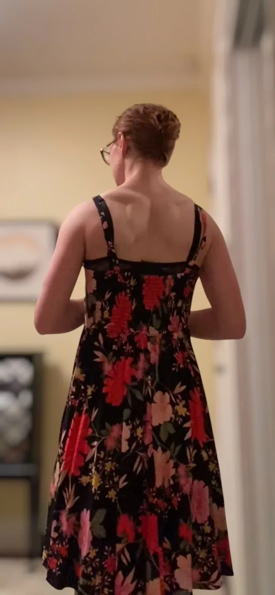 Hannah Burke standing in a floral dress, showing her progress outside the gym